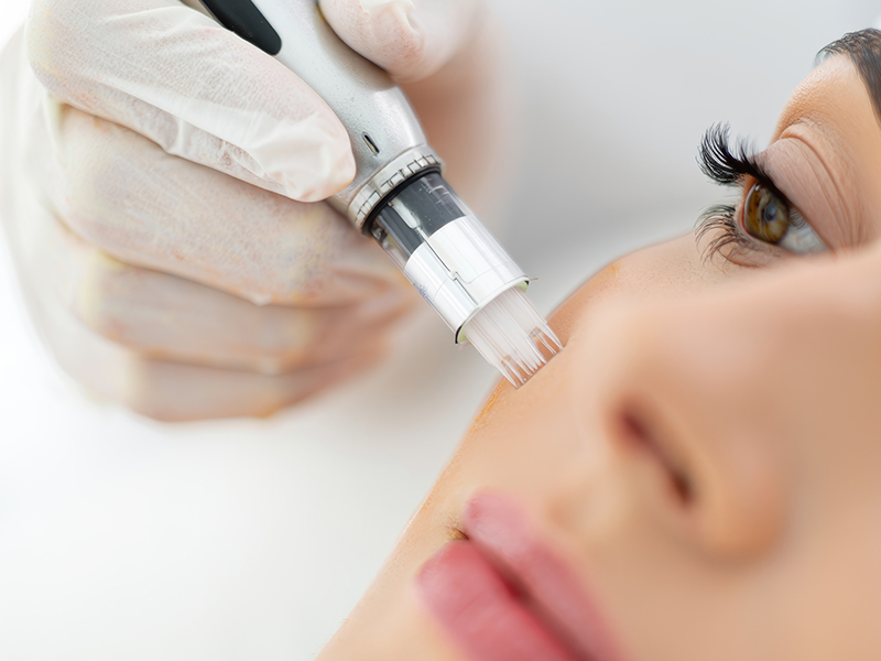 Skin Treatments In Hadleigh, Essex